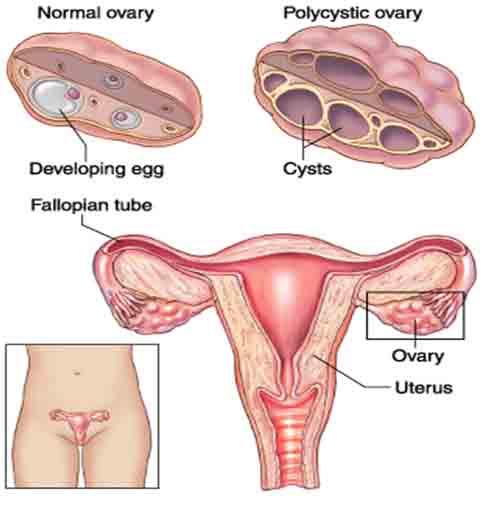infertility clinic in pcmc